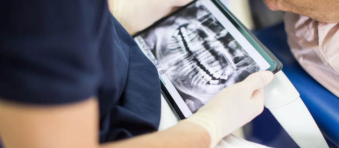 lekarz oglądający zdjęcie rentgenowskie szczęki