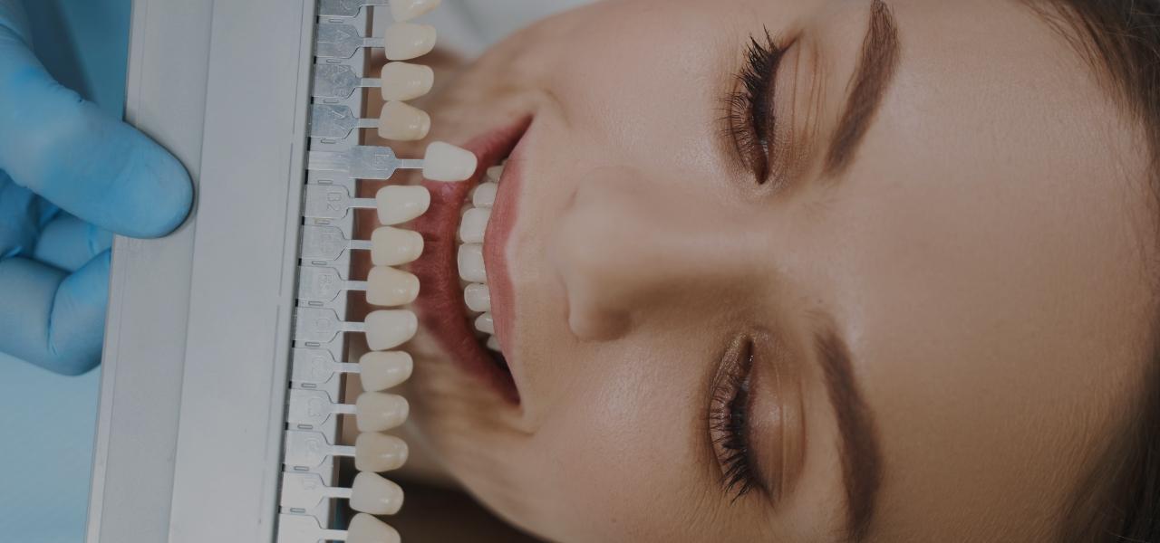 Dentysta sprawdza odcień bieli zębów kobiety